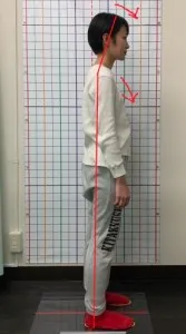 施術後の姿勢